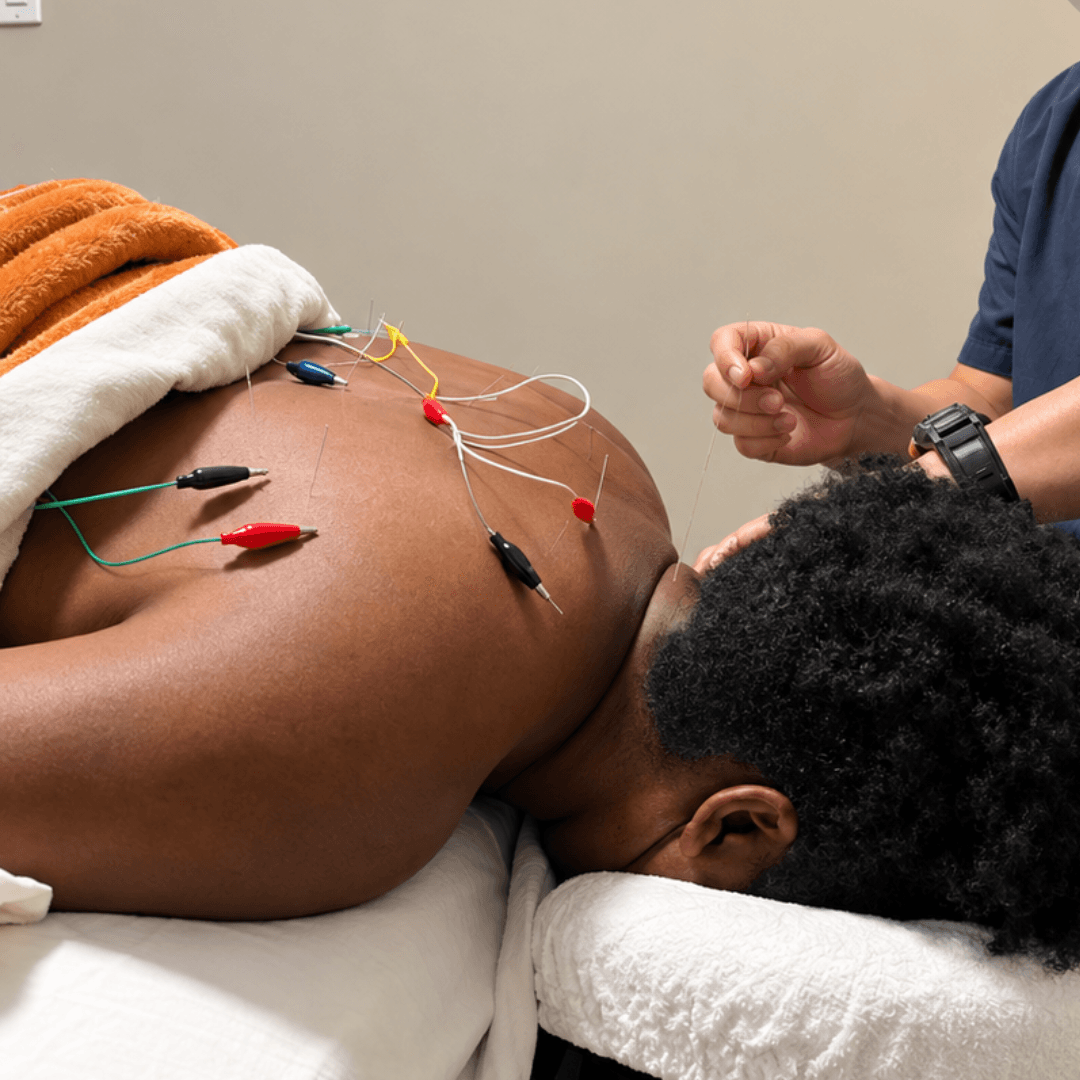 Acupuncture treatment with targeted electrical stimulation.