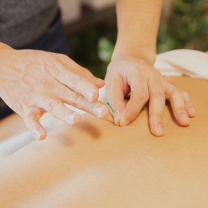 Acupuncture for Emotional Release & Fascia Healing